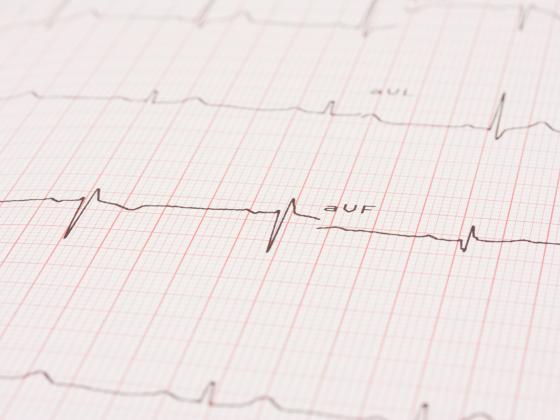 Мужчины и женщины: кто в Израиле чаще умирает от сердечного приступа?