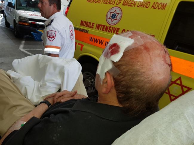 Хайфа: пенсионера жестоко избили на улице средь бела дня