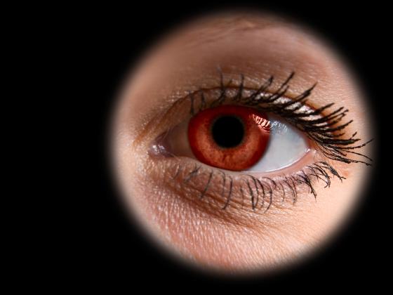 У пожилой британки достали из глаза 27 контактных линз 