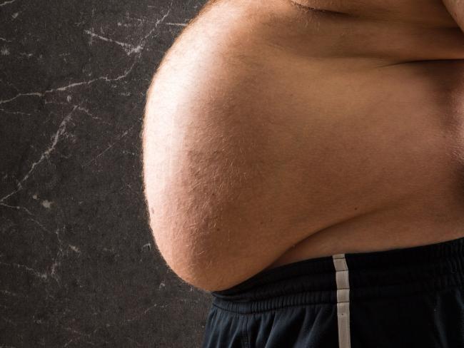 Половина населения Израиля страдает от избыточного веса