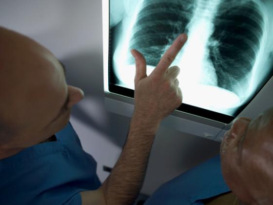 Впервые за 40 лет одобрены новые лекарства от туберкулеза