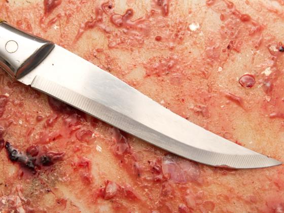 Житель Бат-Яма ударил ножом соседа из-за спора о 100 шекелях