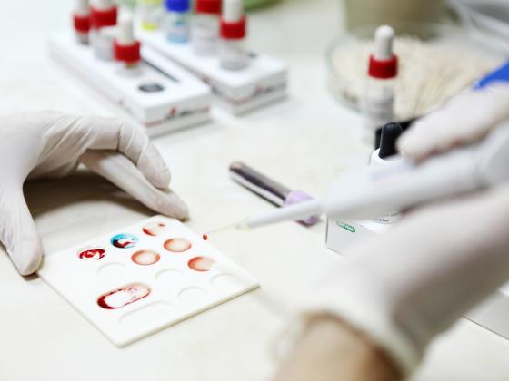 Открытие в Израиле: разработан анализ для выявления рака крови еще до болезни