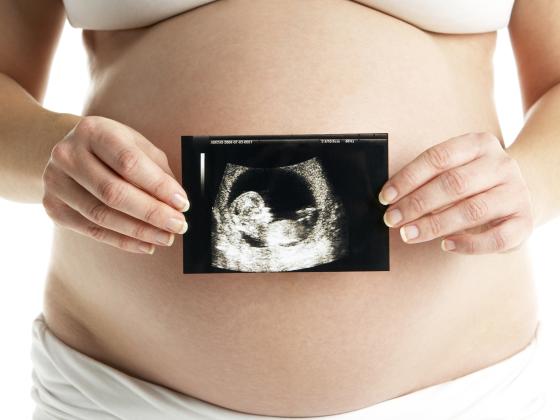 В Израиле родилась девочка с эмбрионом в желудке