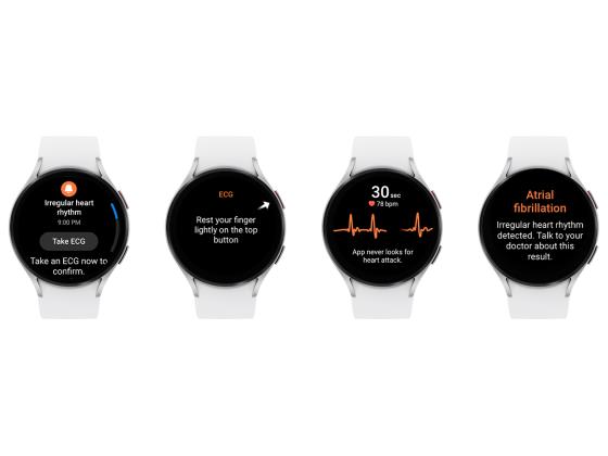 FDA одобряет: Galaxy Watch следит за вашим сердечным ритмом и предотвращает опасность